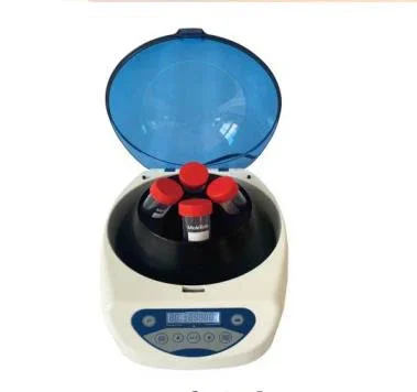 Medical Lab For Sale - ホットセール実験用遠心分離機 医療用ポータブル低速5000rpm 安価でラボや病院に最適